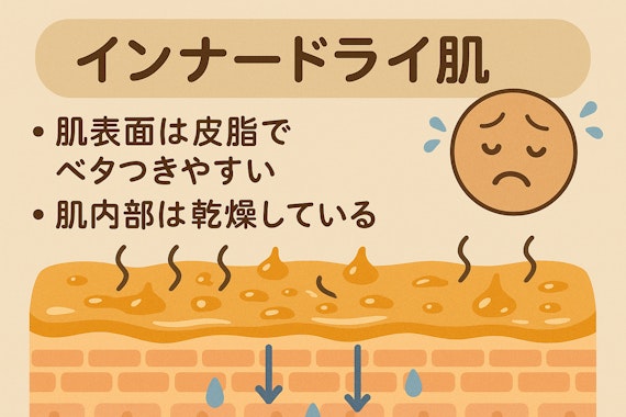 インナードライ