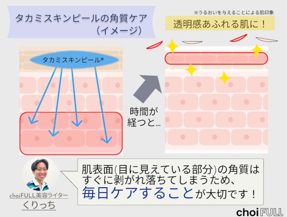 角質層に浸透したタカミスキンピールが、ターンオーバーで表出化する様子のイラスト図解